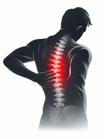 tratamiento de hernia dorsal