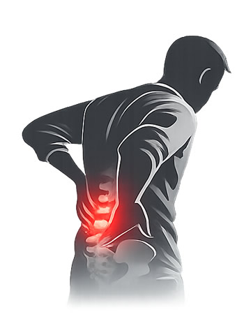 tratamiento de hernia lumbar